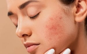 Dermatoloji nedir?