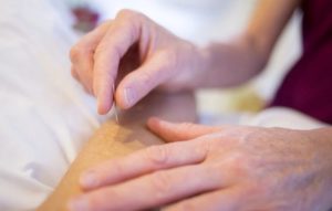 Akupunktur nedir, tedavisi, teşhisi nasıl yapılır? Akupunktur neden olur?